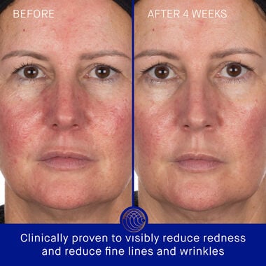 The Hydrogel Face Mask faces the hydrogel face mask