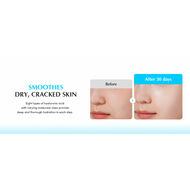 faces أمبول ترطيب عميق