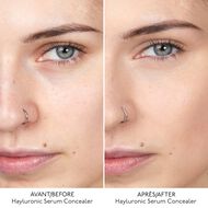 faces hyaluronic serum