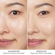 Hyaluronic Serum faces hyaluronic serum