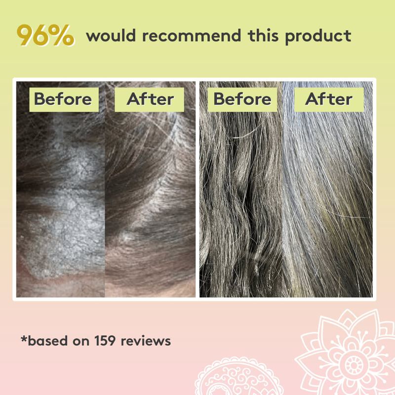 delhicious rich roots hair & scalp amla & rosemary