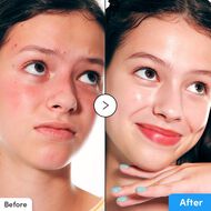 faces سيروم هيالتوين المرطب