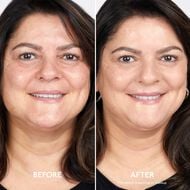 Brightening CC faces brightening cc