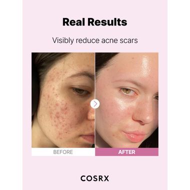 faces the niacinamide 15