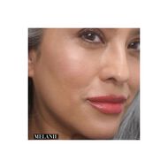 faces legendary serum