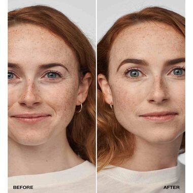 faces ايفين بيتر  كلينيكال مع عامل حماية من الشمس 20