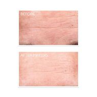 faces retinol resurgence youth renewal