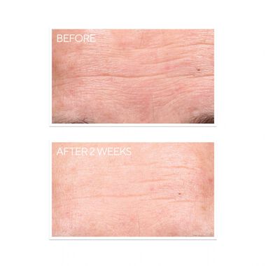 faces retinol resurgence youth renewal
