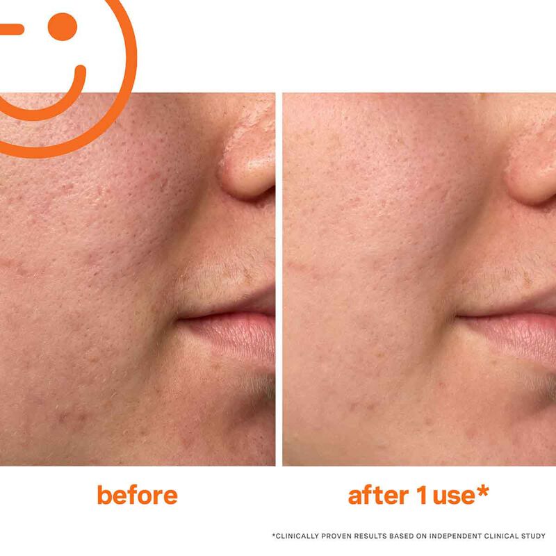 كيت سومرفيل معالج تقشير مكثف من إكسفولييت