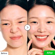 faces سيروم مهدئ بالألوفيرا وpdrn