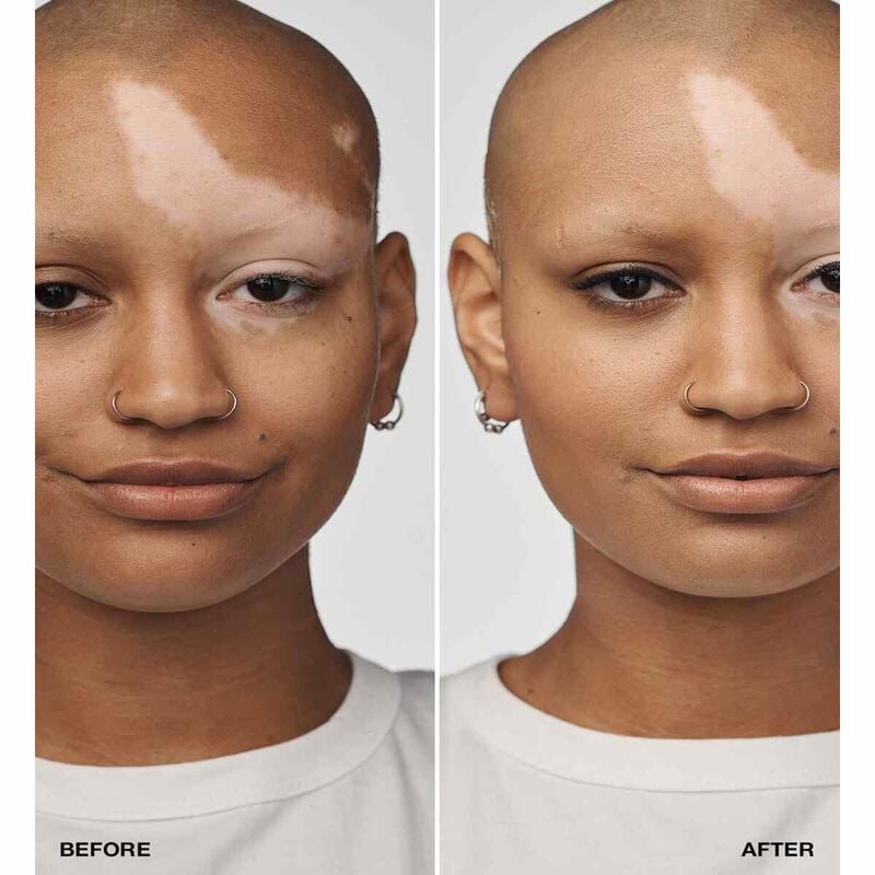 كلينيك ايفين بيتر كلينيكال مع عامل حماية من الشمس 20