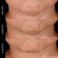 faces كريم رينيرجي المعزّز بـ300 نوع من الببتيدات