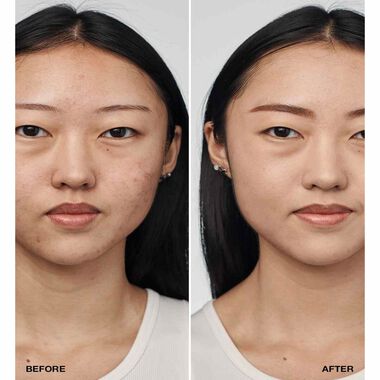 Even Better Clinical Serum Foundation with SPF 20 faces even better clinical serum foundation with spf 20