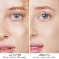 faces hyaluronic serum