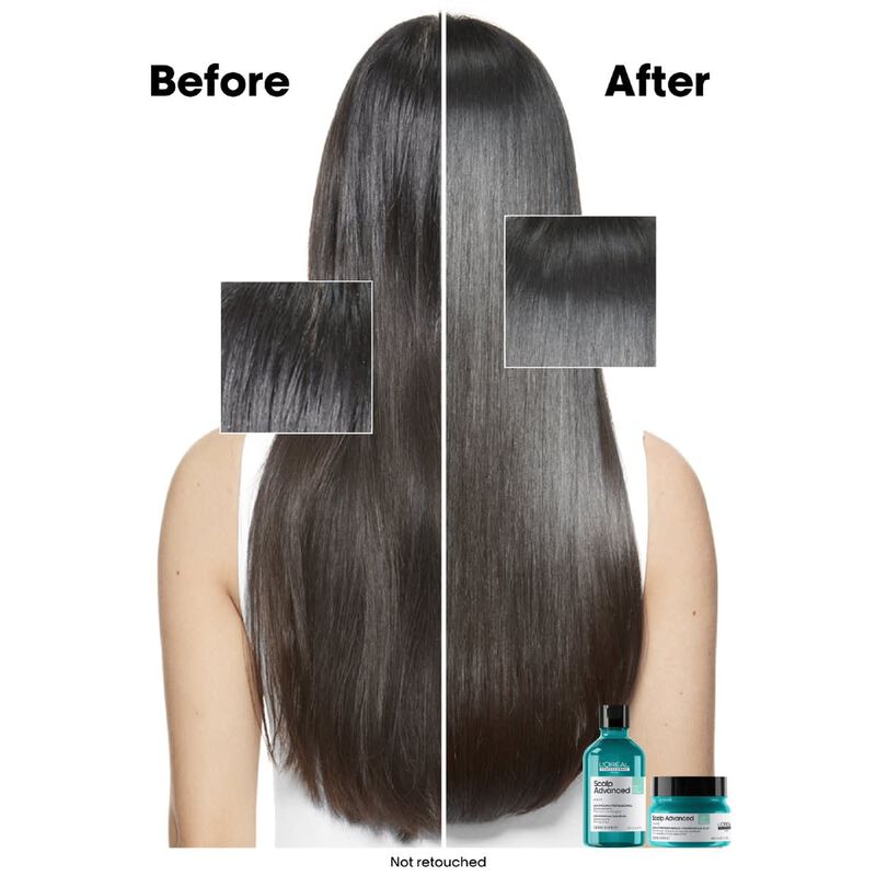 loreal professionnel scalp advanced antioiliness mask