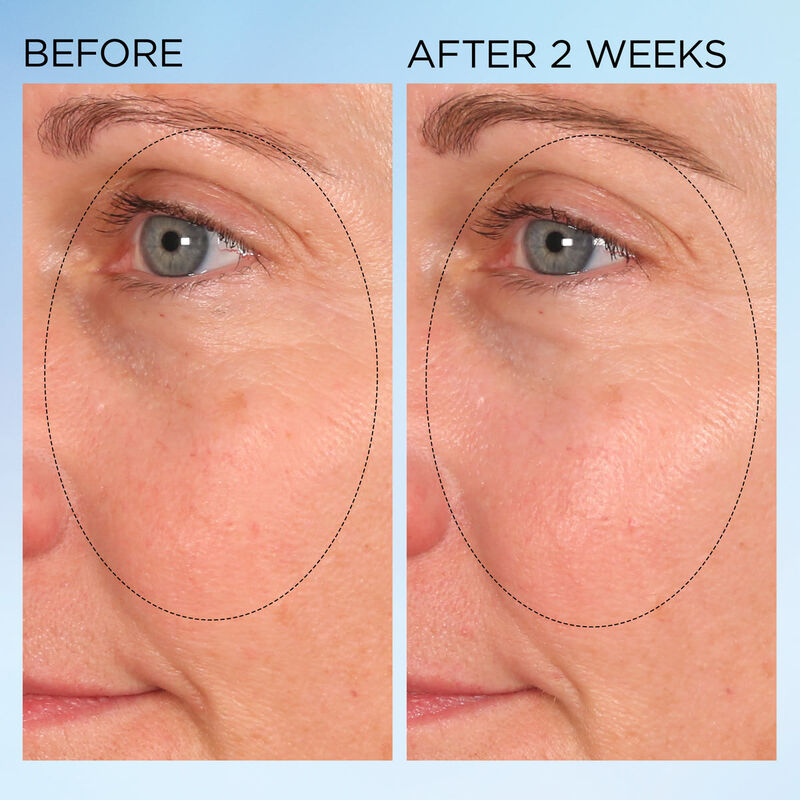 elizabeth arden visible brightening clearly radiant spot correcting  capsules