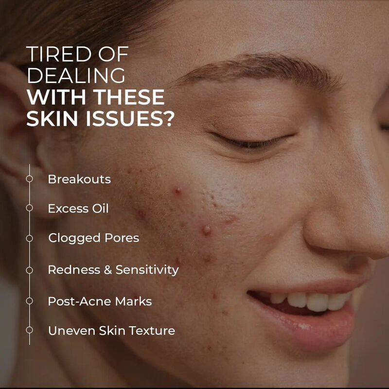 skin centrick تونر لحب لشباب