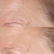 faces فيتامين سي إستر اليومي لتفتيح البشرة وتقشيرها