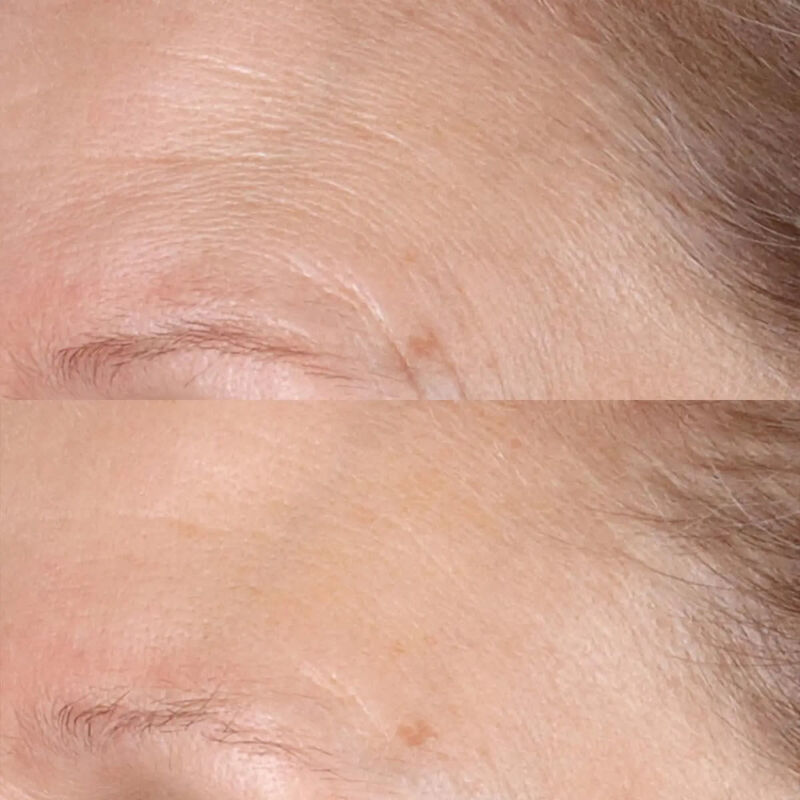 بيريكون إم دي فيتامين سي إستر اليومي لتفتيح البشرة وتقشيرها