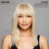 faces bond building repair treatment