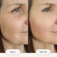 Face Lift EMS Mask faces face lift ems mask