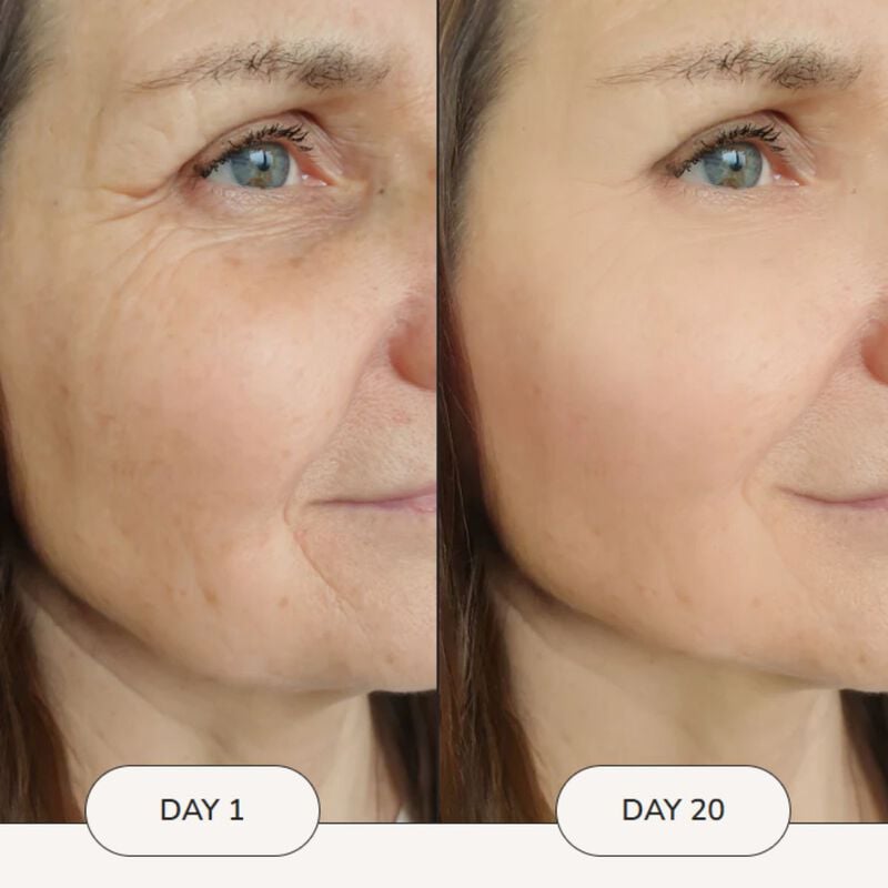 jovs face lift ems mask