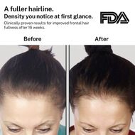 faces powerflex 272 hair growth laser light cap