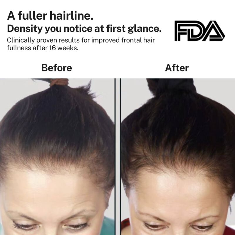 hairmax powerflex 272 hair growth laser light cap