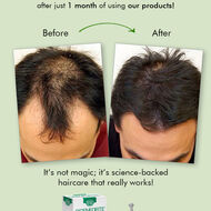 faces zero hair fall set