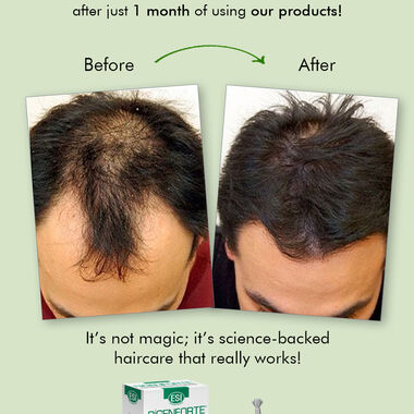 faces zero hair fall set