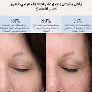 faces رقع العين led للعلاج بالضوء الأحمر   هيدروكولويد