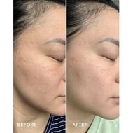 faces radiance grape stem cell plus squalane day cream