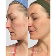 غسول منعش بالبابايا و حمض الساليسيليك 100 جرام faces غسول منعش بالبابايا و حمض الساليسيليك 100 جرام