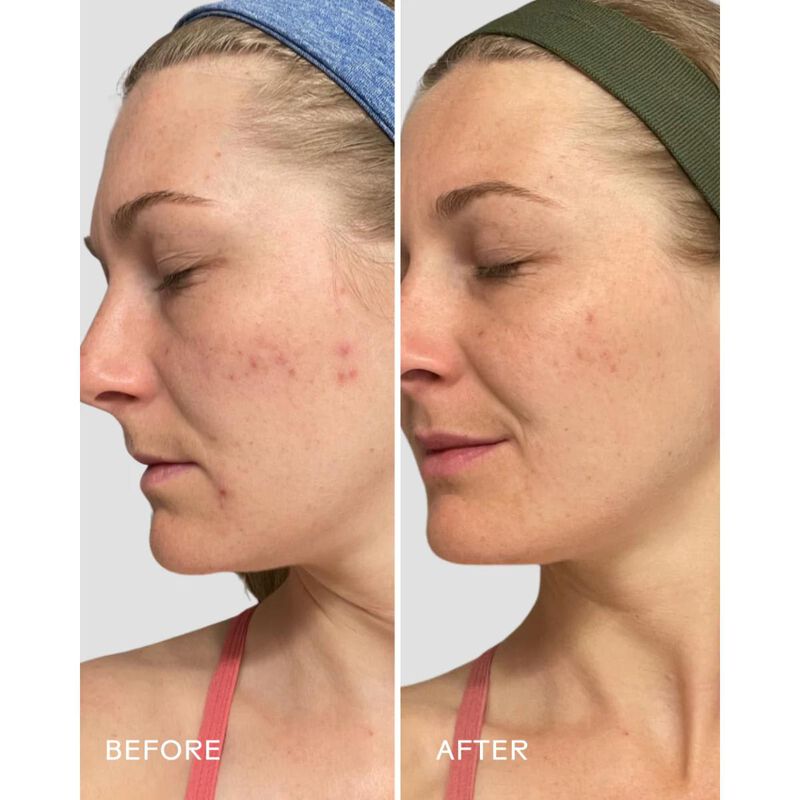 ثري شيبس غسول منعش بالبابايا و حمض الساليسيليك 100 جرام