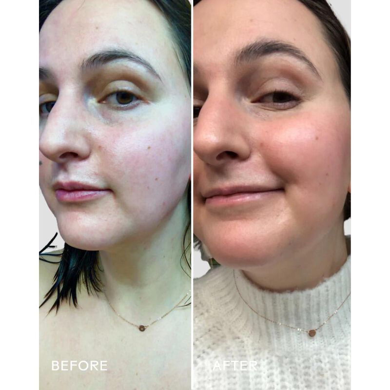 three ships skin hero bakuchiol + calendula bioretinol serum