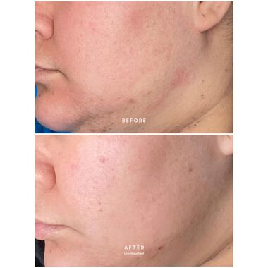 faces calm pure radiance oil