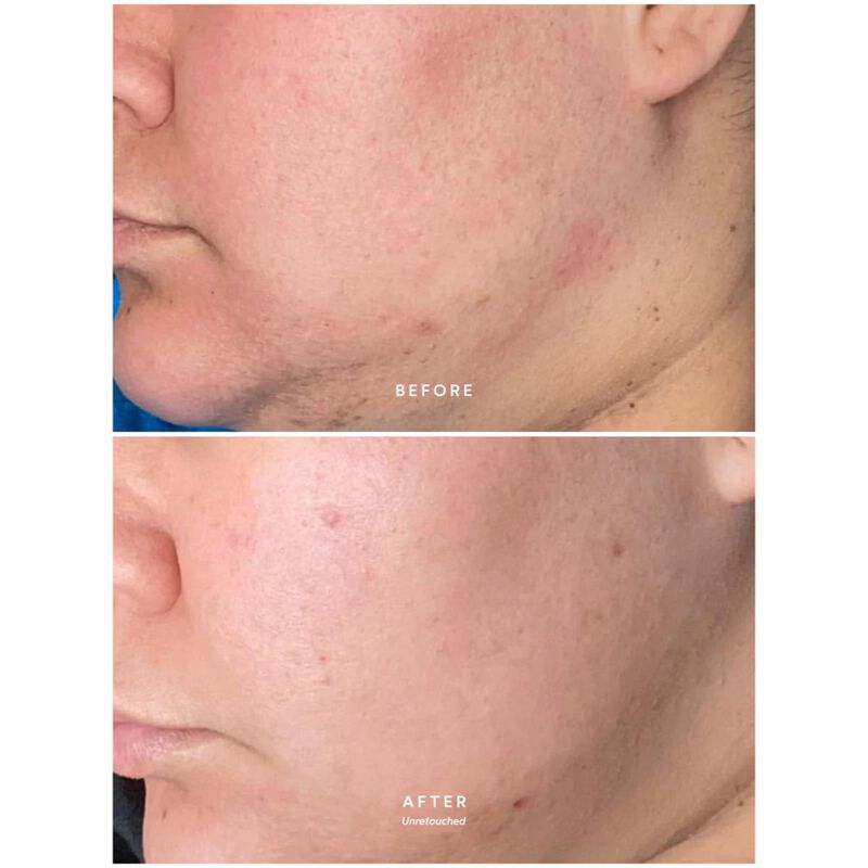 true botanicals calm pure radiance oil