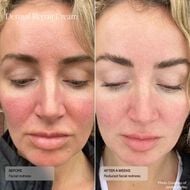 Dermal Repair Cream faces dermal repair cream