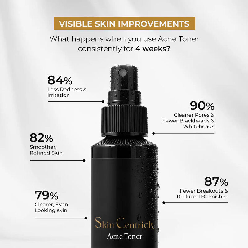 skin centrick تونر لحب لشباب