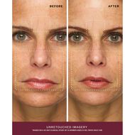 faces radiance face serum