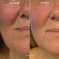 faces renew repair nightly treatment