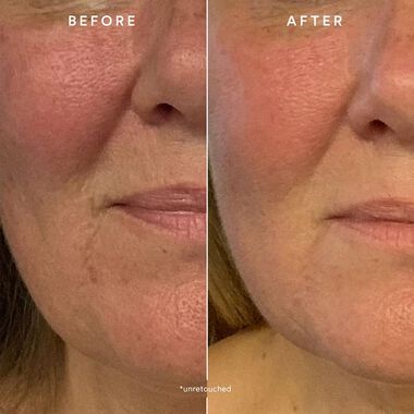 faces renew repair nightly treatment