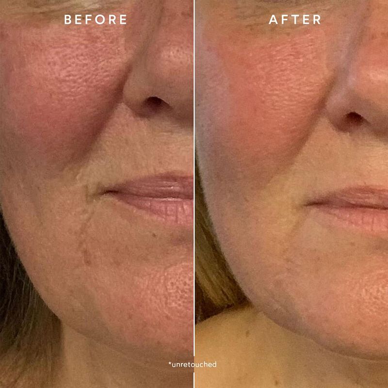 true botanicals renew repair nightly treatment