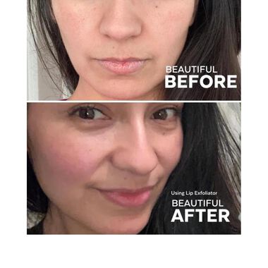 faces hydrating lip treatment kit