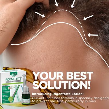 faces لوشن المكثف للشعر