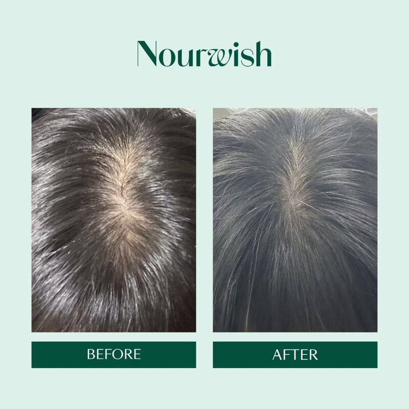 نورويش شامبو تجديد فروة الرأس سكالـب ريتريت