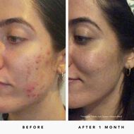 faces blue tansy aha   bha clarity mask