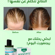 faces zero hair fall set