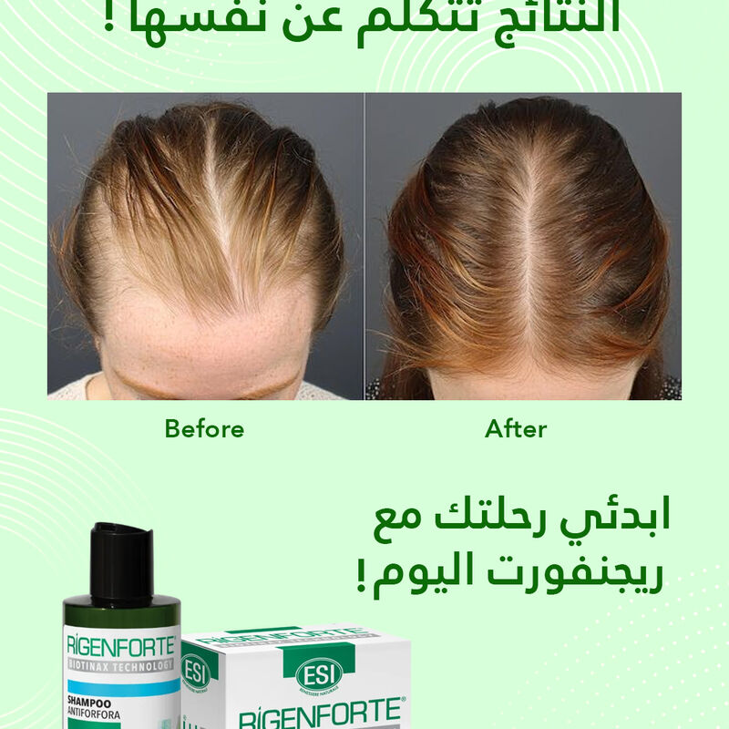 rigenforte zero hair fall set