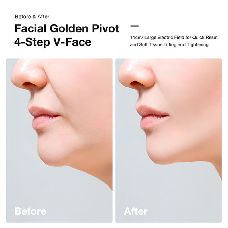 jovs vlift antiageing device